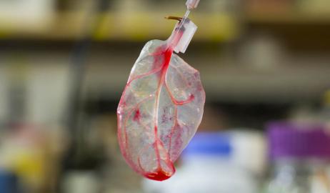 Το φύλλο του σπανακιού μετασχηματίζεται σε ανθρώπινο λειτουργικό καρδιακό ιστό